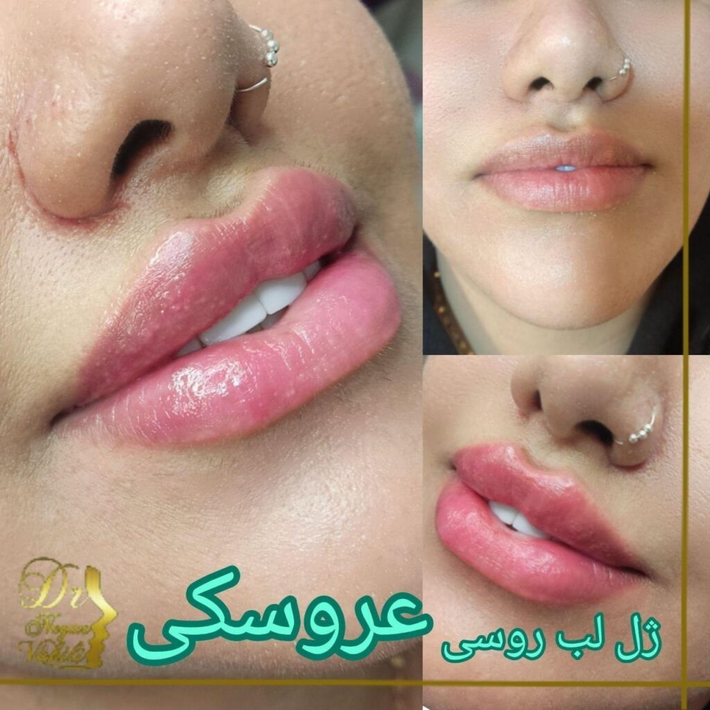 تصویر گالری مرکز لیزر کلینیک زیبایی دکتر نگار وکیلی