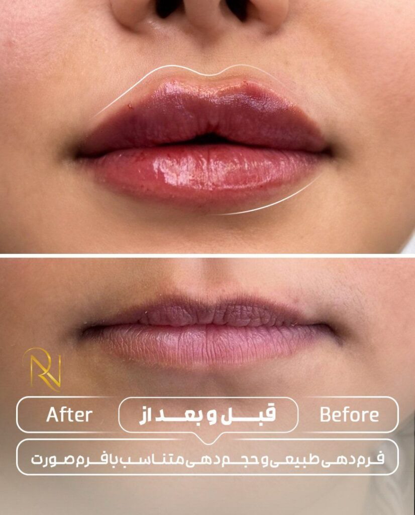 تصویر گالری کلینیک زیبایی و لیزر نورارُز